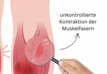 Wadenkrämpfe in der Nacht – Ursachen & Lösungen Ursache eines Wadenkrampfes Lupe