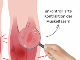 Wadenkrämpfe in der Nacht – Ursachen & Lösungen Ursache eines Wadenkrampfes Lupe